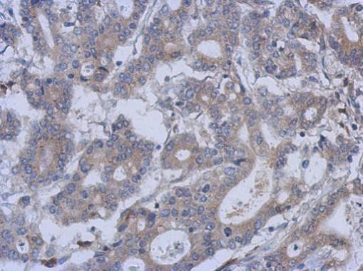 FUZ Antibody in Immunohistochemistry (Paraffin) (IHC (P))