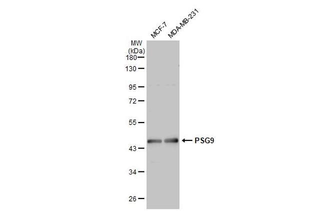 PSG9 Antibody in Western Blot (WB)