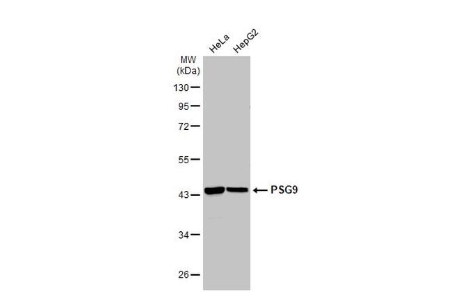 PSG9 Antibody in Western Blot (WB)