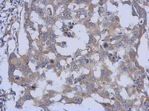 PARS2 Antibody in Immunohistochemistry (Paraffin) (IHC (P))