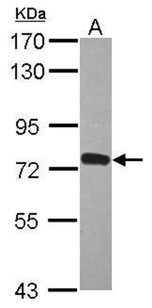 ZNF417 Antibody in Western Blot (WB)