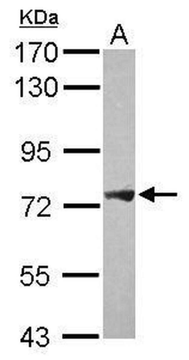 PLA2G4F Antibody in Western Blot (WB)