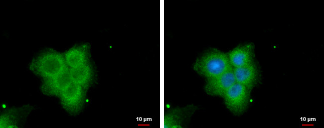 PLA2G4F Antibody in Immunocytochemistry (ICC/IF)