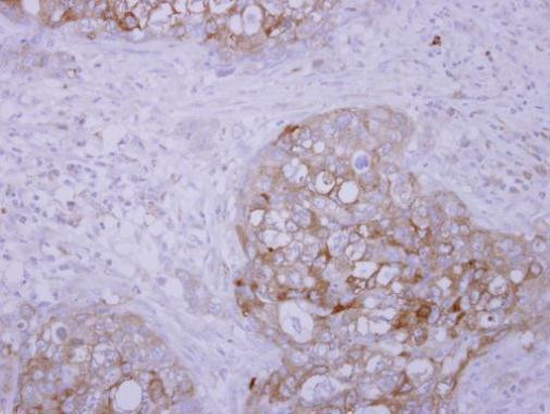 SCFD1 Antibody in Immunohistochemistry (Paraffin) (IHC (P))