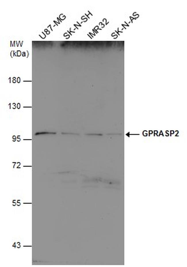 GPRASP2 Antibody in Western Blot (WB)