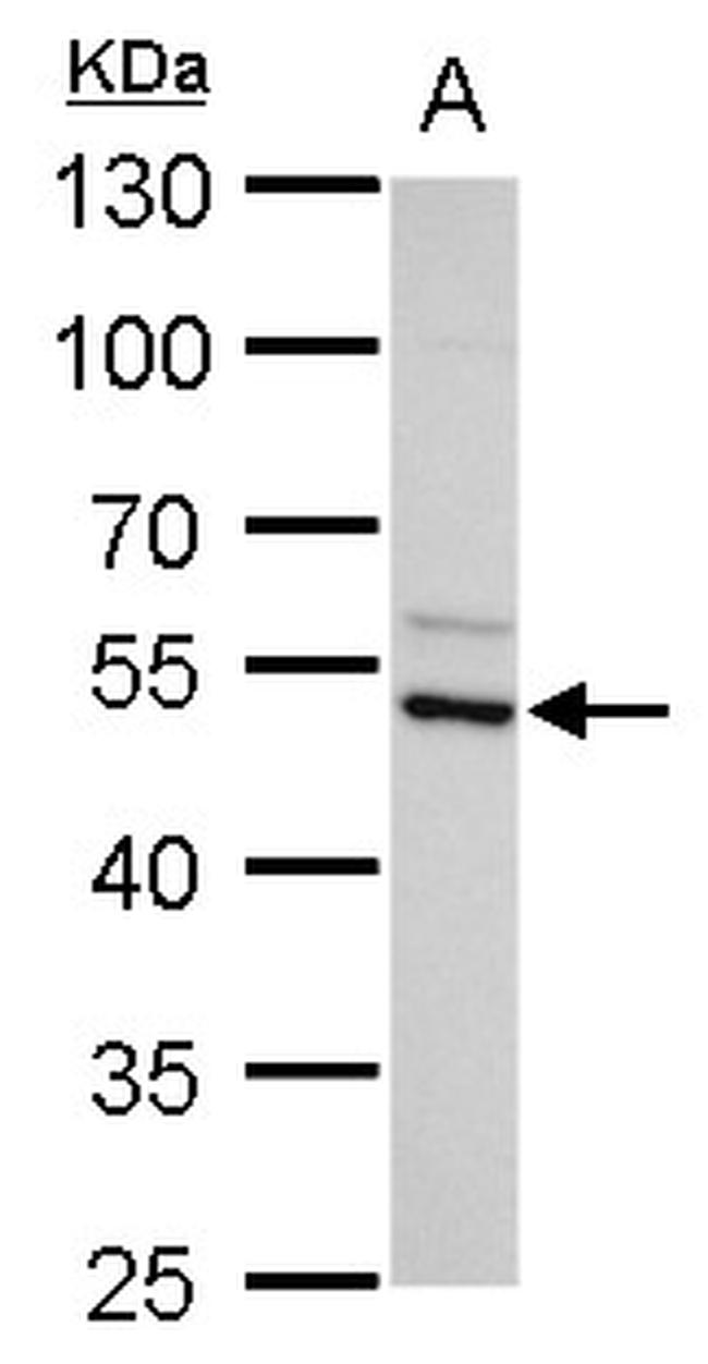 ADC Antibody in Western Blot (WB)