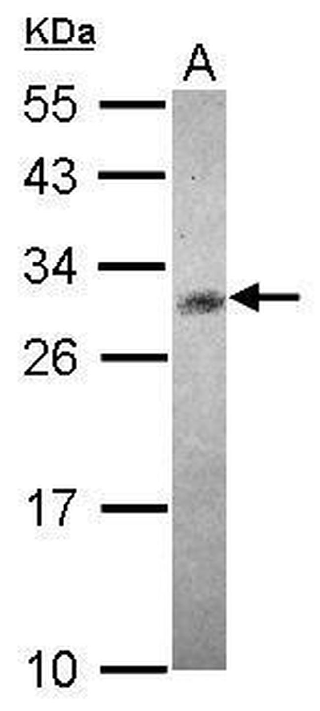 CHAC1 Antibody in Western Blot (WB)