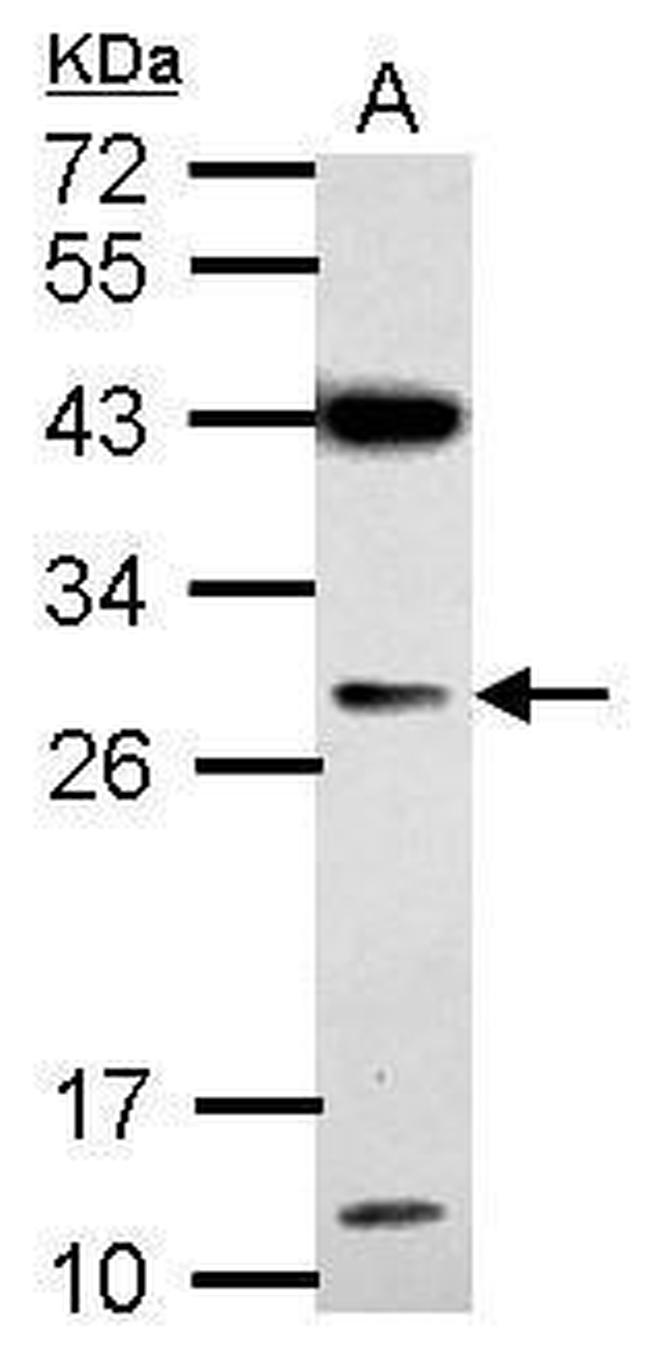IMP4 Antibody in Western Blot (WB)
