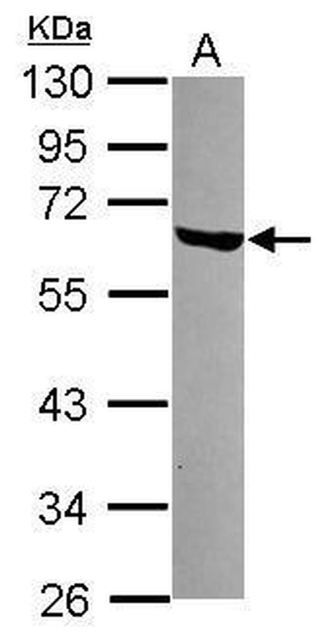 LSM14A Antibody in Western Blot (WB)