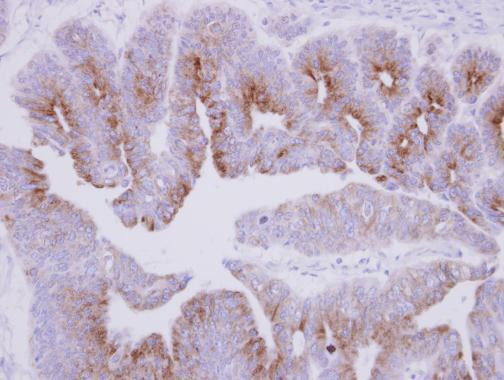 MAP7 Antibody in Immunohistochemistry (Paraffin) (IHC (P))