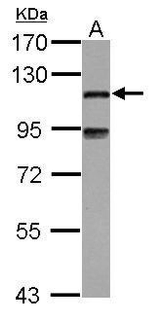 MAP7 Antibody in Western Blot (WB)