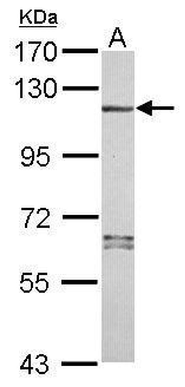 NALP7 Antibody in Western Blot (WB)