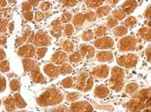 SEMA4B Antibody in Immunohistochemistry (Paraffin) (IHC (P))