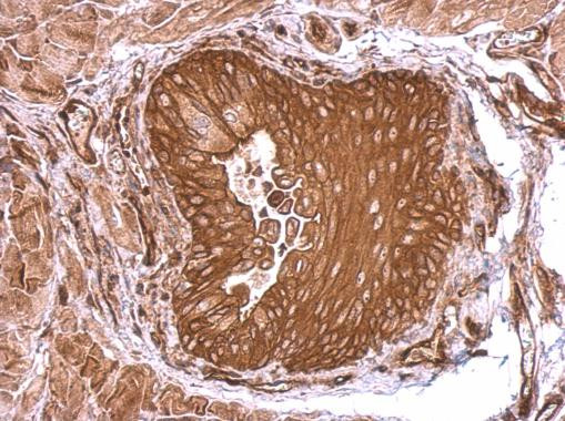 SEMA4B Antibody in Immunohistochemistry (Paraffin) (IHC (P))