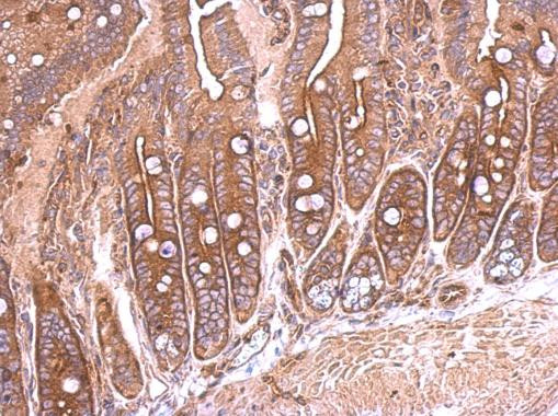 SEMA4B Antibody in Immunohistochemistry (Paraffin) (IHC (P))