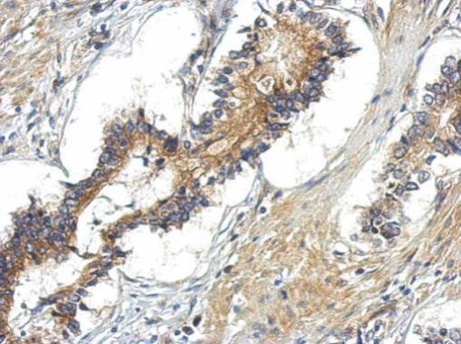 TBC1D15 Antibody in Immunohistochemistry (Paraffin) (IHC (P))