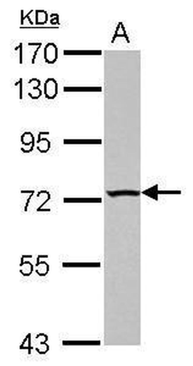 TBC1D15 Antibody in Western Blot (WB)