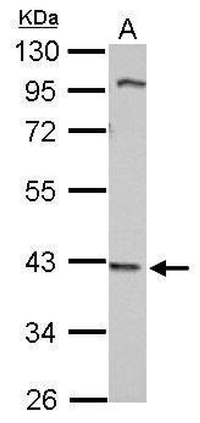 WDR69 Antibody in Western Blot (WB)