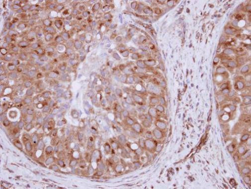 XPO6 Antibody in Immunohistochemistry (Paraffin) (IHC (P))