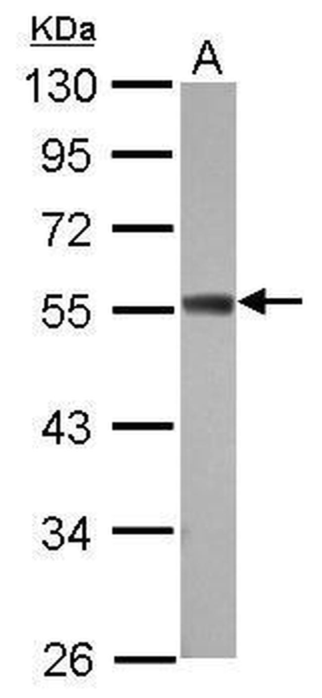 ZC3H10 Antibody in Western Blot (WB)