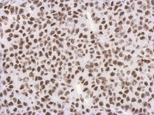 H3K27me3 Antibody in Immunohistochemistry (Paraffin) (IHC (P))