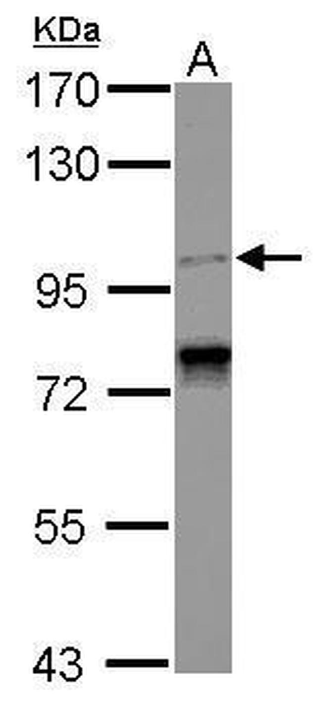 SPICE1 Antibody in Western Blot (WB)