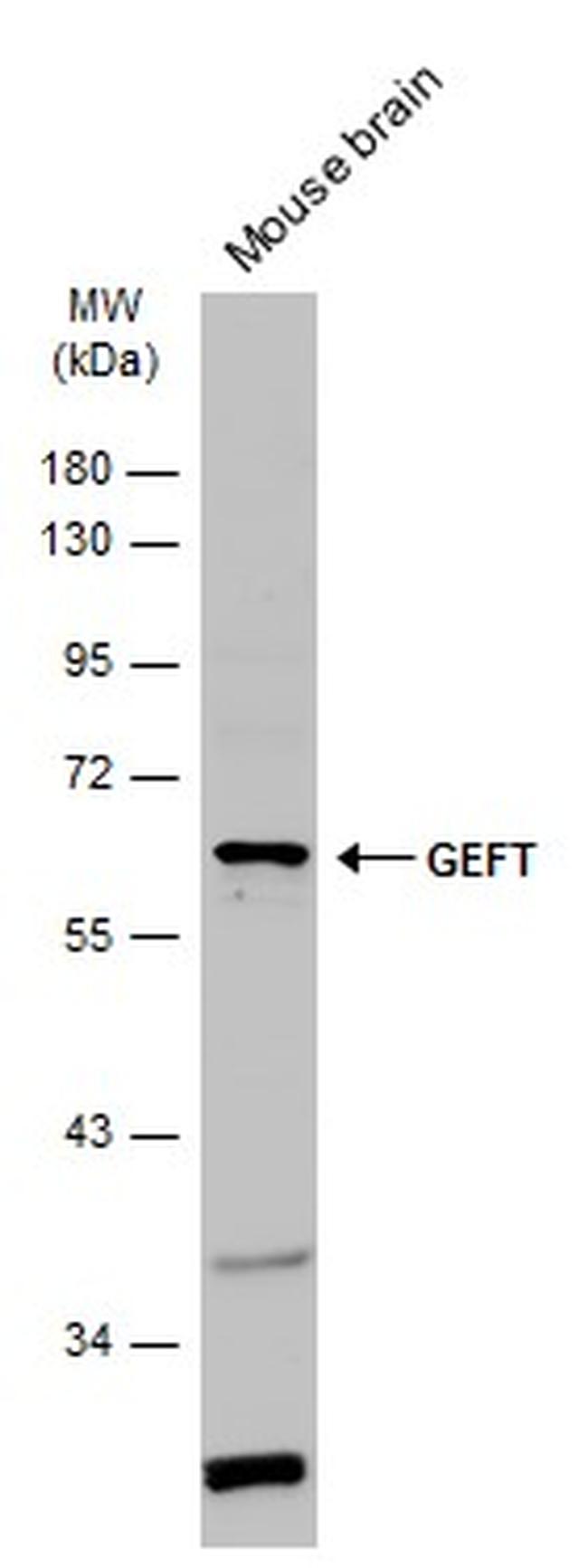 GEFT Antibody in Western Blot (WB)