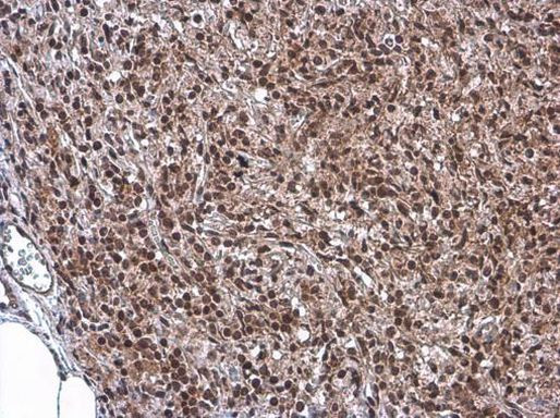 KDM6A Antibody in Immunohistochemistry (Paraffin) (IHC (P))