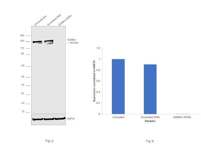 KDM6A Antibody