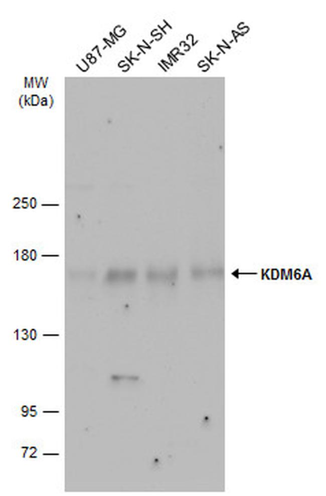 KDM6A Antibody in Western Blot (WB)