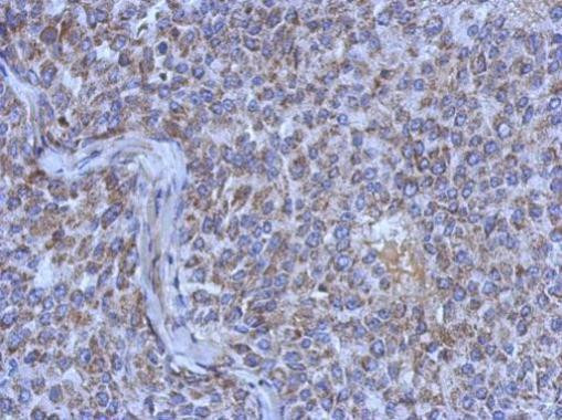 MRPL44 Antibody in Immunohistochemistry (Paraffin) (IHC (P))