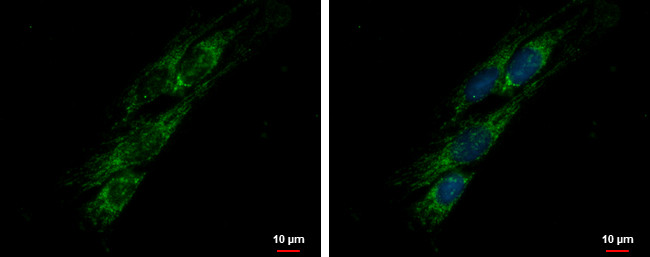 PITRM1 Antibody in Immunocytochemistry (ICC/IF)