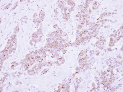 PSD4 Antibody in Immunohistochemistry (Paraffin) (IHC (P))