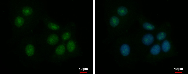 ZNF417 Antibody in Immunocytochemistry (ICC/IF)