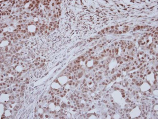 ZNF417 Antibody in Immunohistochemistry (Paraffin) (IHC (P))