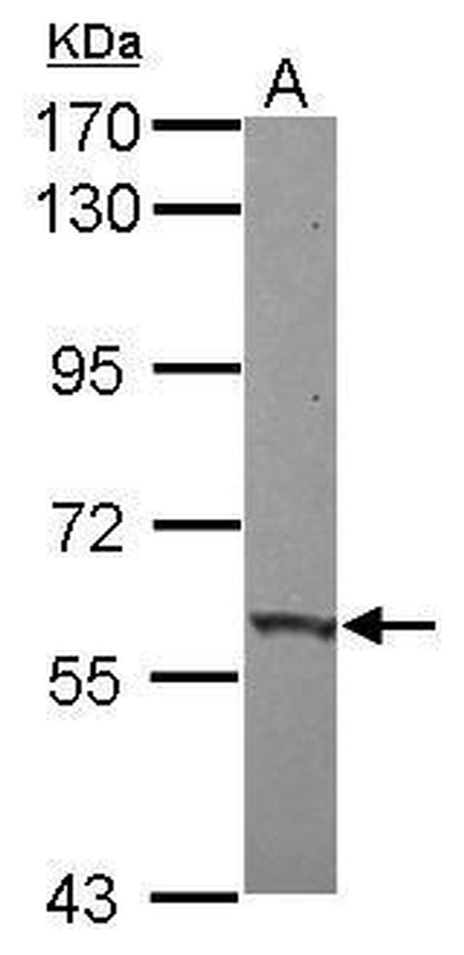 ZNF417 Antibody in Western Blot (WB)