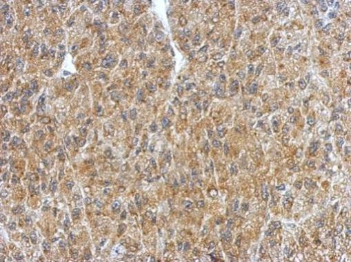 BRUNOL4 Antibody in Immunohistochemistry (Paraffin) (IHC (P))