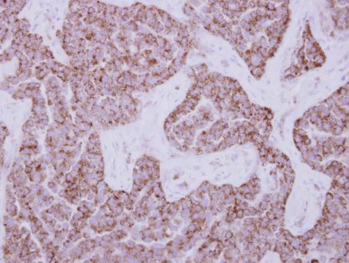 DUS2L Antibody in Immunohistochemistry (Paraffin) (IHC (P))