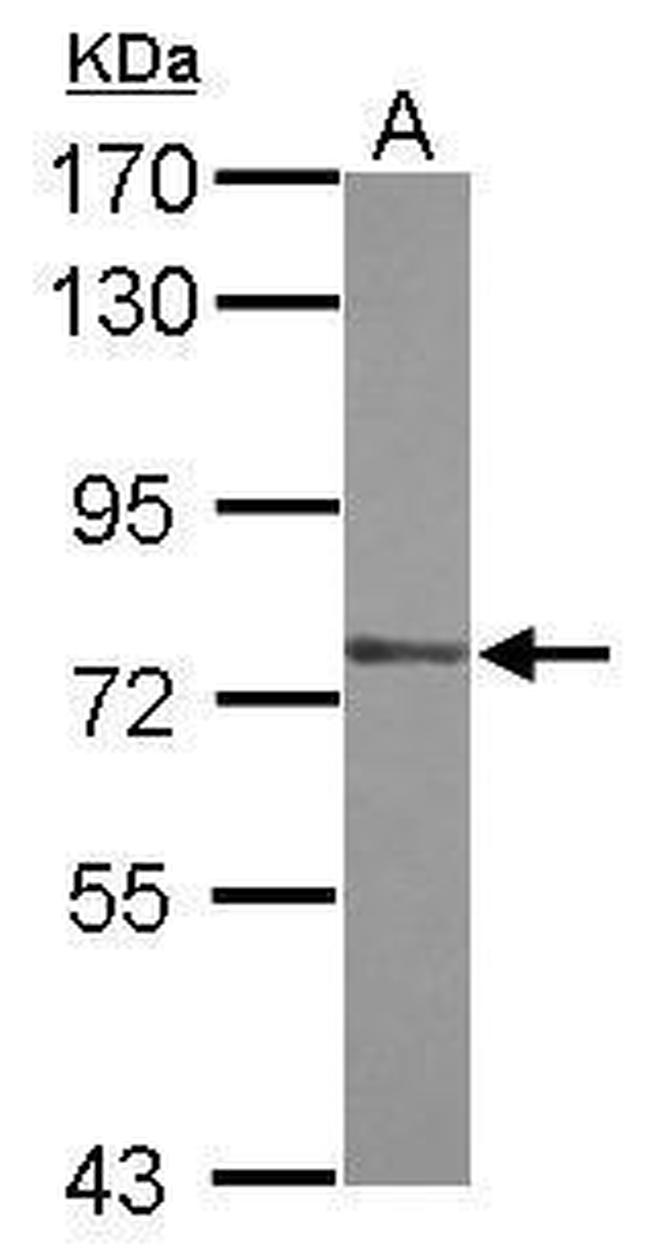 ZXDA Antibody in Western Blot (WB)