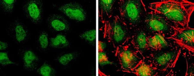 TET3 Antibody in Immunocytochemistry (ICC/IF)