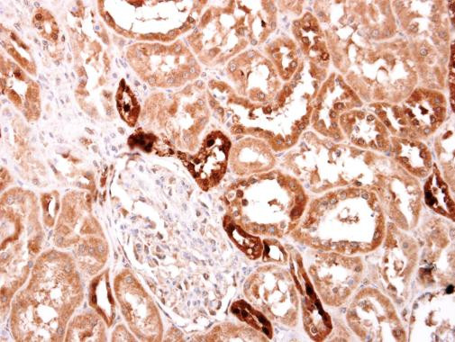 S100A2 Antibody in Immunohistochemistry (Paraffin) (IHC (P))