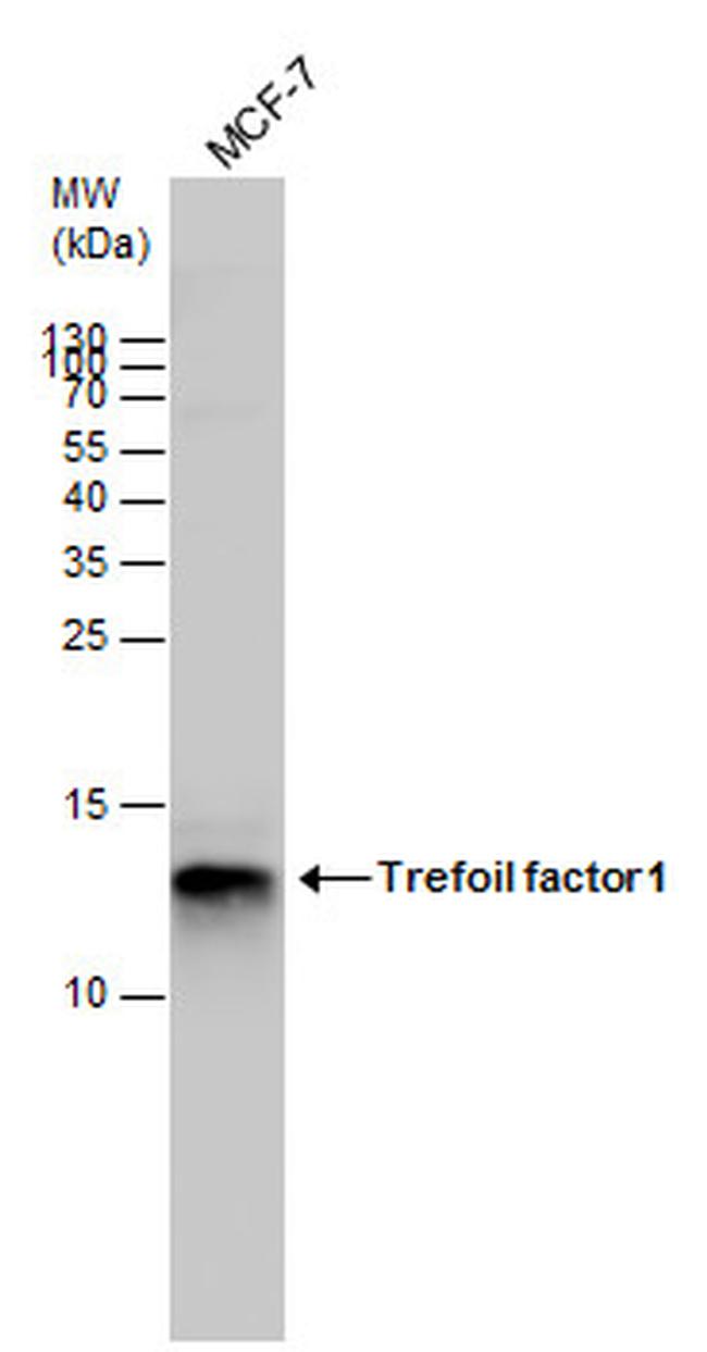 TFF1 Antibody in Western Blot (WB)