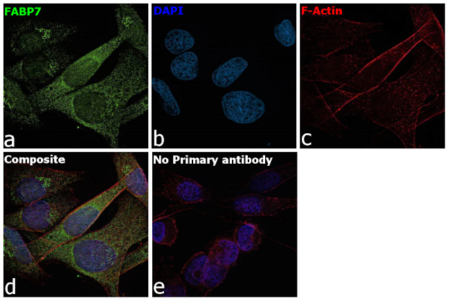 FABP7 Antibody in Immunocytochemistry (ICC/IF)