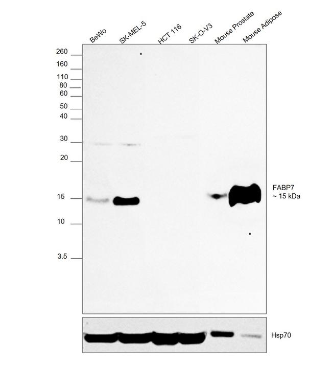 FABP7 Antibody in Western Blot (WB)