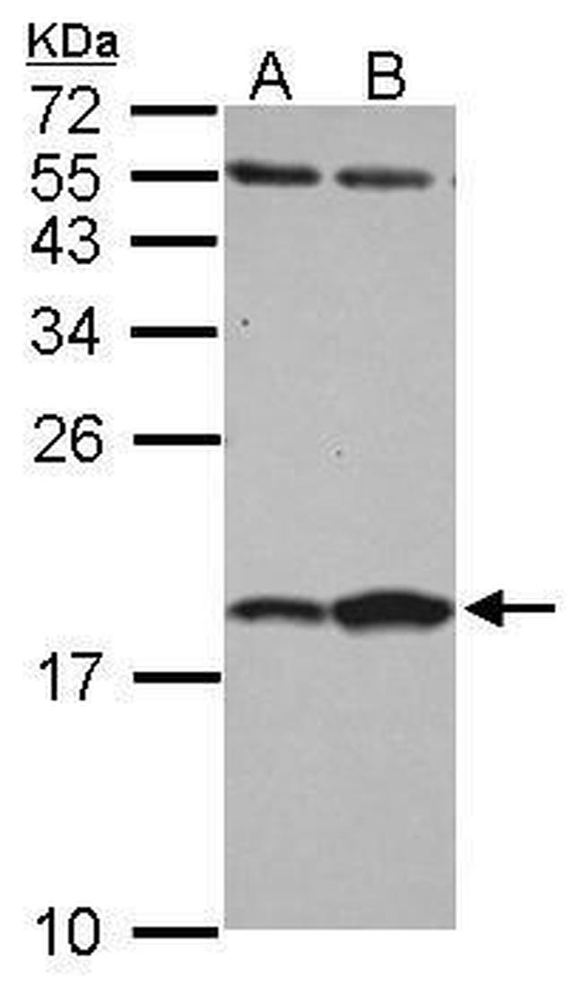 FABP7 Antibody in Western Blot (WB)