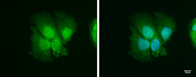 ISG15 Antibody in Immunocytochemistry (ICC/IF)