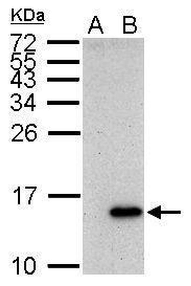 Galectin 7 Antibody in Western Blot (WB)