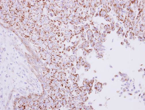 RHAMM Antibody in Immunohistochemistry (Paraffin) (IHC (P))