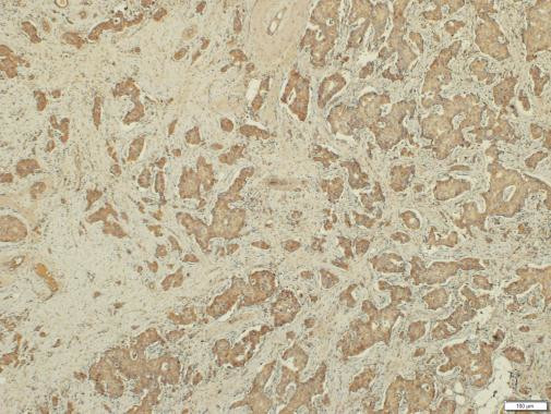 RHAMM Antibody in Immunohistochemistry (Paraffin) (IHC (P))