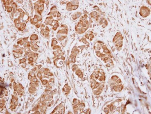 IL17RD Antibody in Immunohistochemistry (Paraffin) (IHC (P))